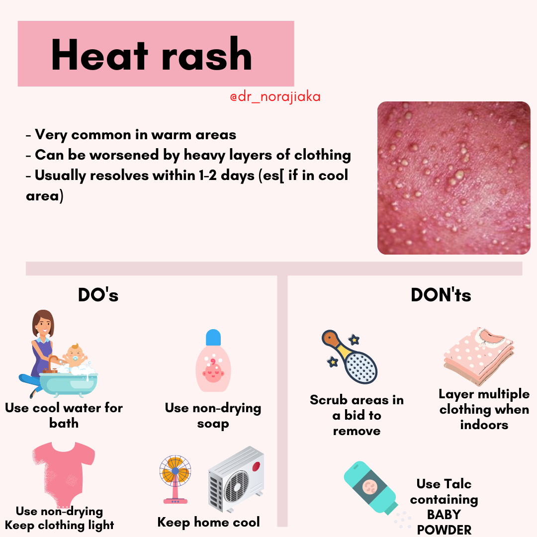 Pin on Heat rash