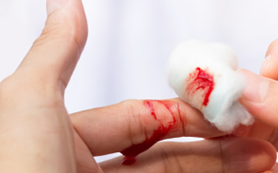 How to properly stop a bleeding wound